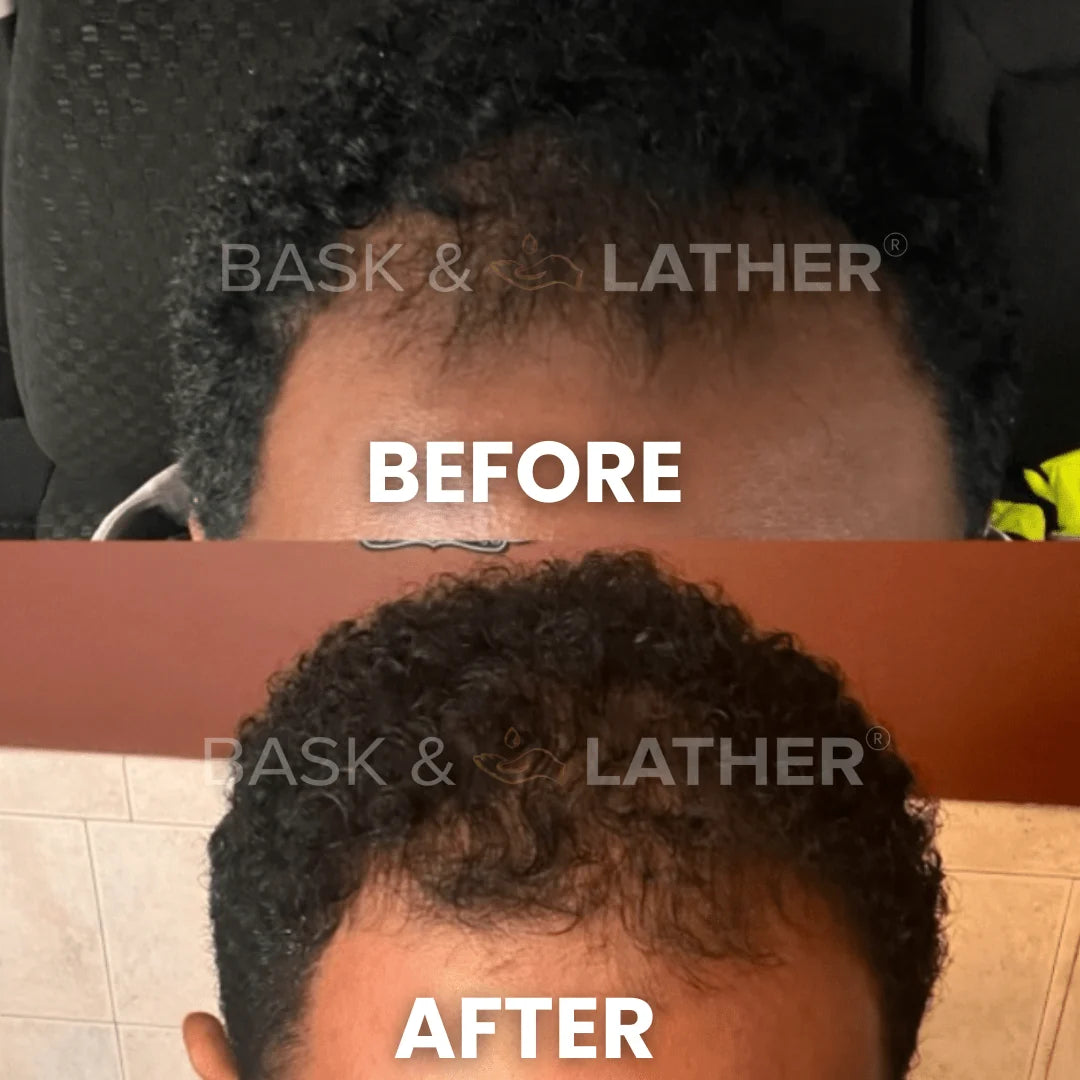 Bask & Lather Scalp Stimulator Hair Growth Oil 2 fl oz (59 ml)